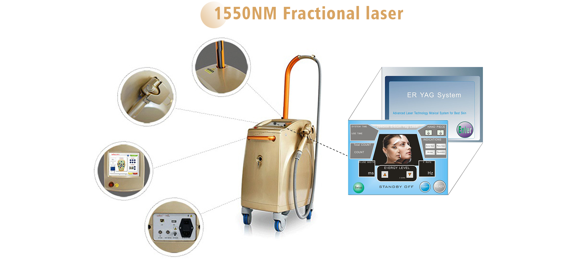 1550 nm erbium laser